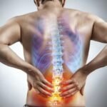 Sciatica Pain