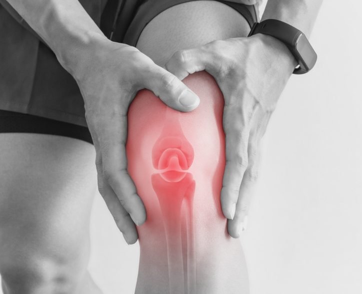 5 Best Physiotherapy Exercise To Reduce Knee Pain