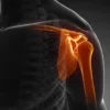 A Guide to Shoulder Injuries