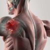 IS SHOULDER RESURFACING RIGHT FOR YOU?