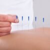 Menstrual Pain and Acupuncture in Kitchener