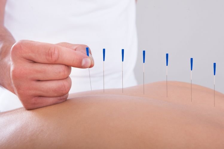 Menstrual Pain and Acupuncture in Kitchener