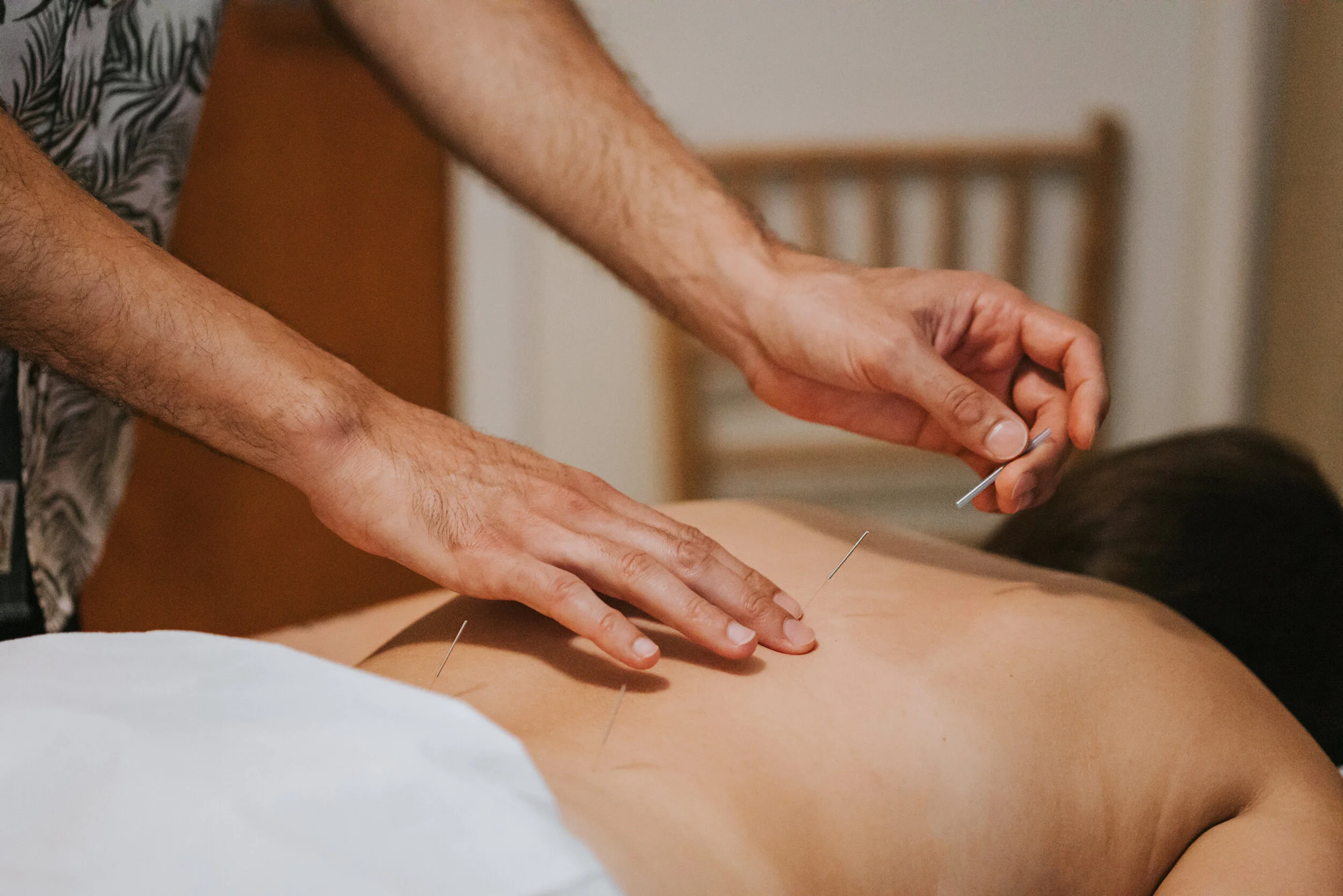 Back Pain Relief with Acupuncture in Kitchener