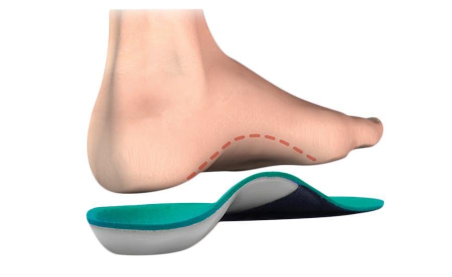 Do custom orthotics provide arch support?