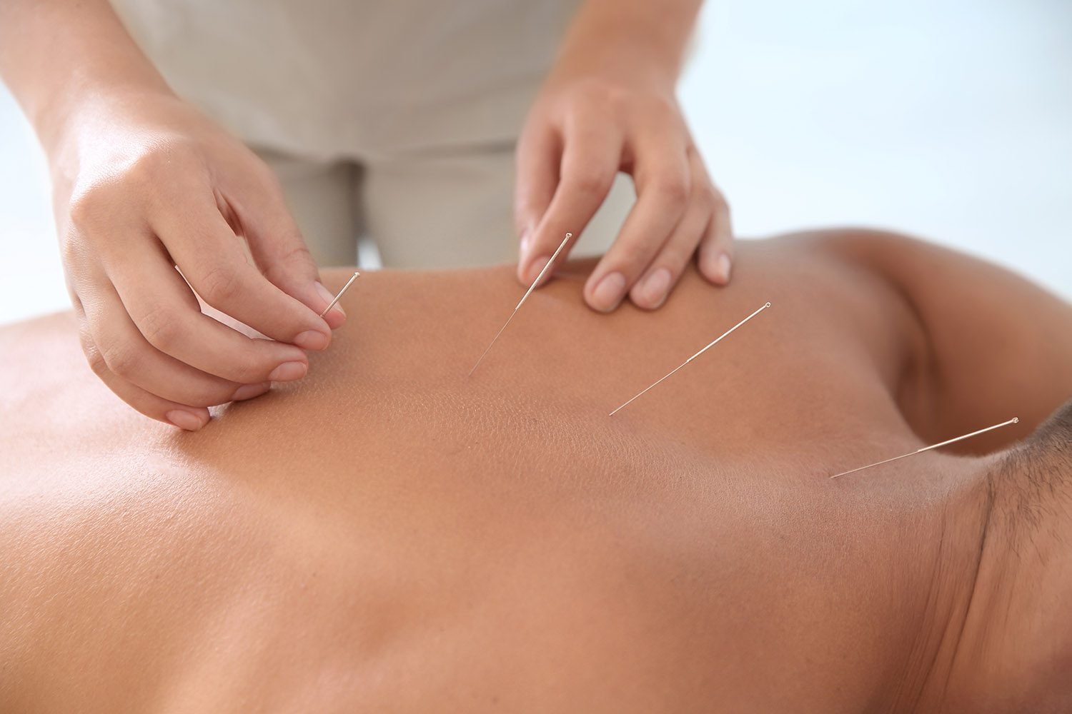 A Complete Guide to Acupuncture Therapy in Kitchener: How It Works and Its Benefits for Pain